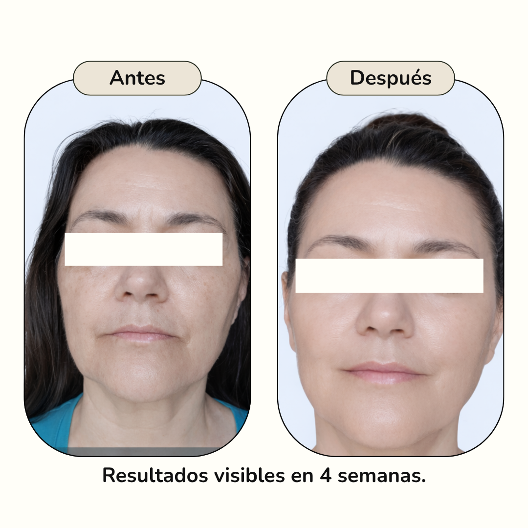 KIT - RENOVACIÓN PROFUNDA