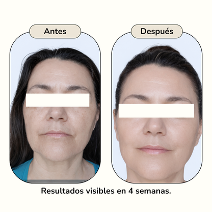 KIT - RENOVACIÓN PROFUNDA