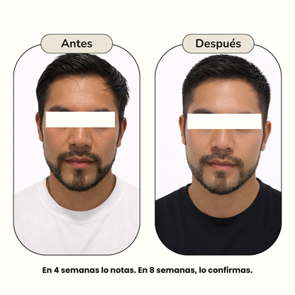KIT - TRANSFORMACIÓN 360°
