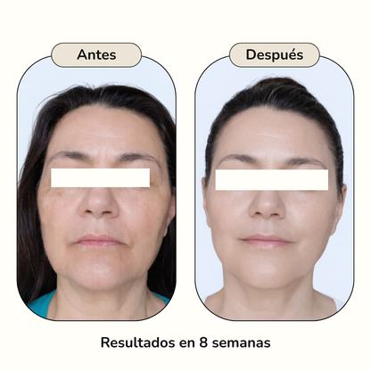 ANTIMANCHAS
